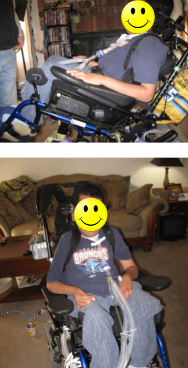 Side and front views of a client in custom molded seating that uses a ventilator