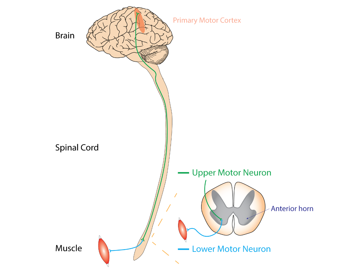 Diagram of bulbar neuron impairment