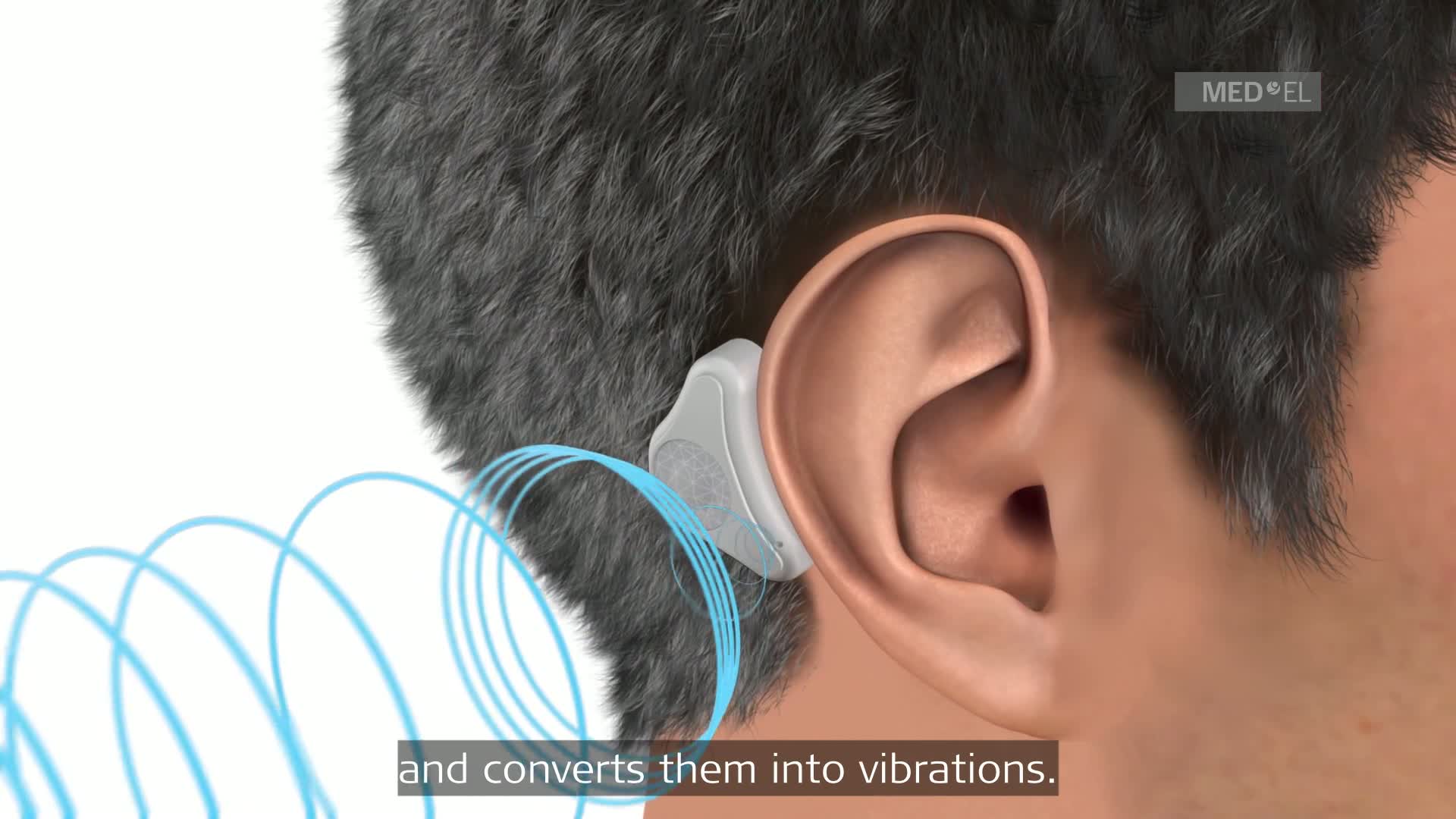Screenshot from video reviewing how the ADHEAR works