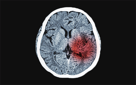 an x-ray of the human brain