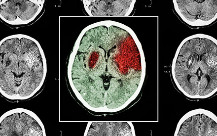 an xray of a human brain